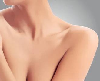 Close-up of a woman's neck and decolletage for Ultherapy skin lifting in Amsterdam